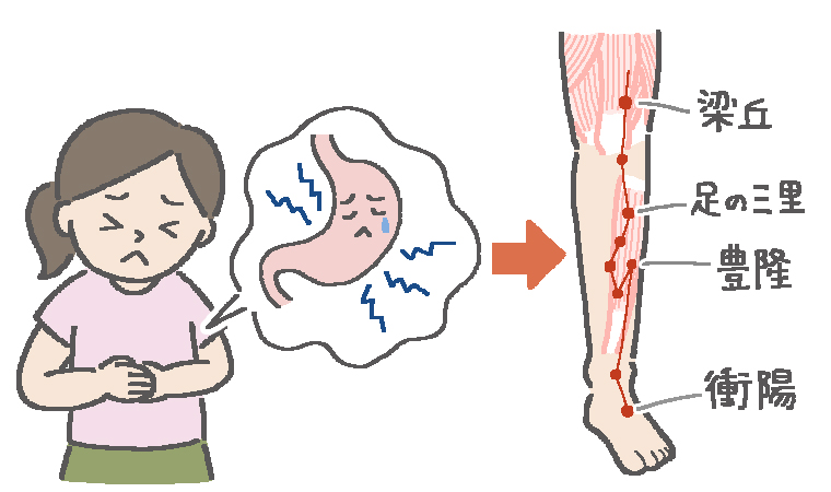 胃の女性不調