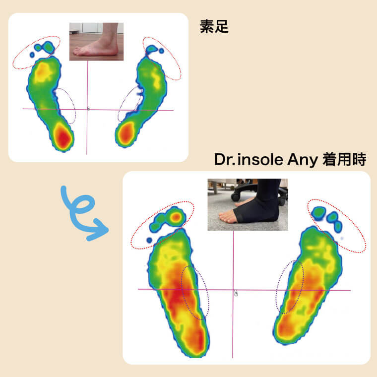 Dr.insole Any着用時の効果
