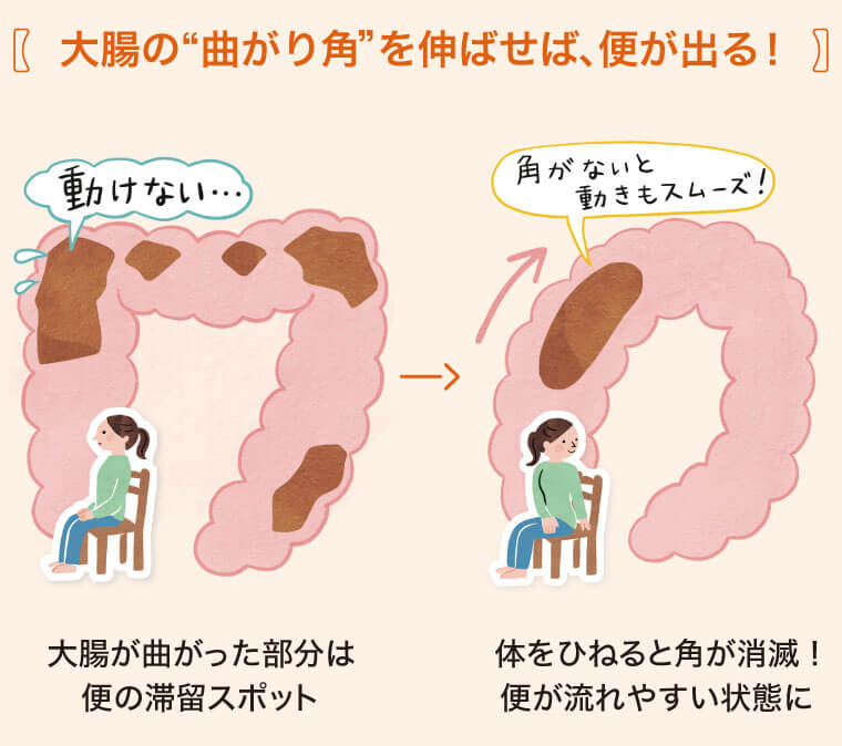 大腸の曲がり角を伸ばせば、弁が出る！