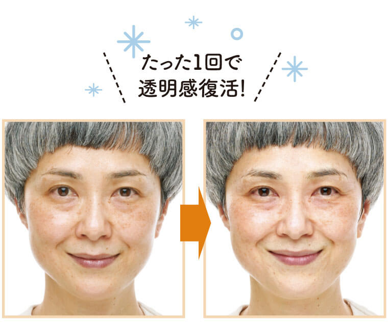 酒かすパック　Before & After