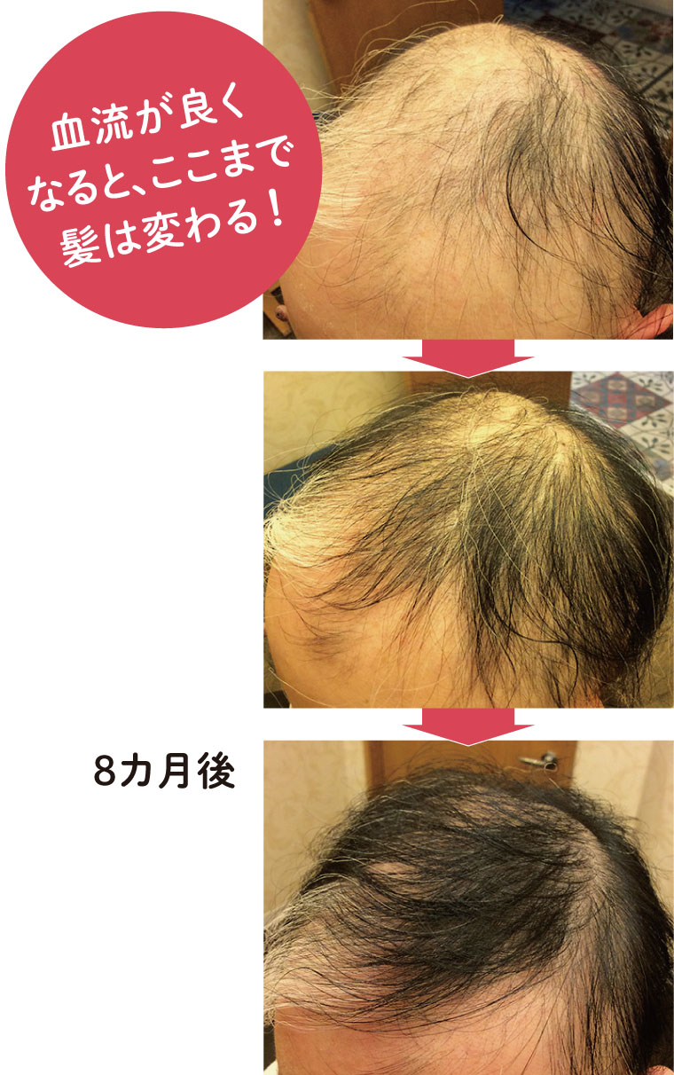 血流が良くなるとここまで髪は変わる！　Before & After