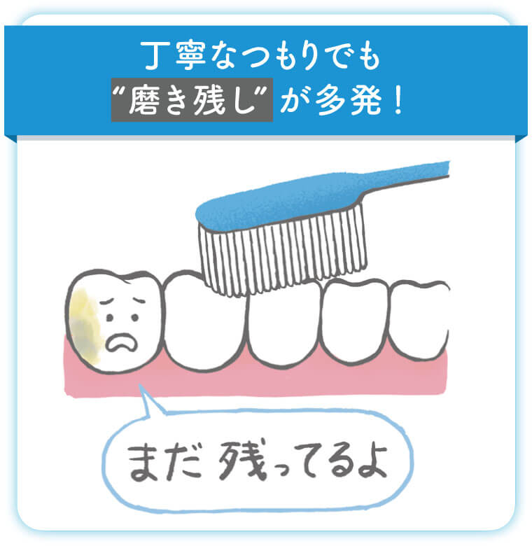 丁寧なつもりでも“磨き残し”が多発！