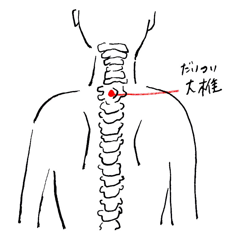 大椎