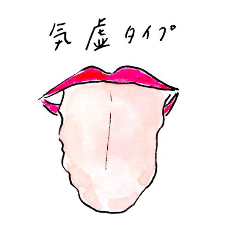 「気虚（ききょ）」タイプ