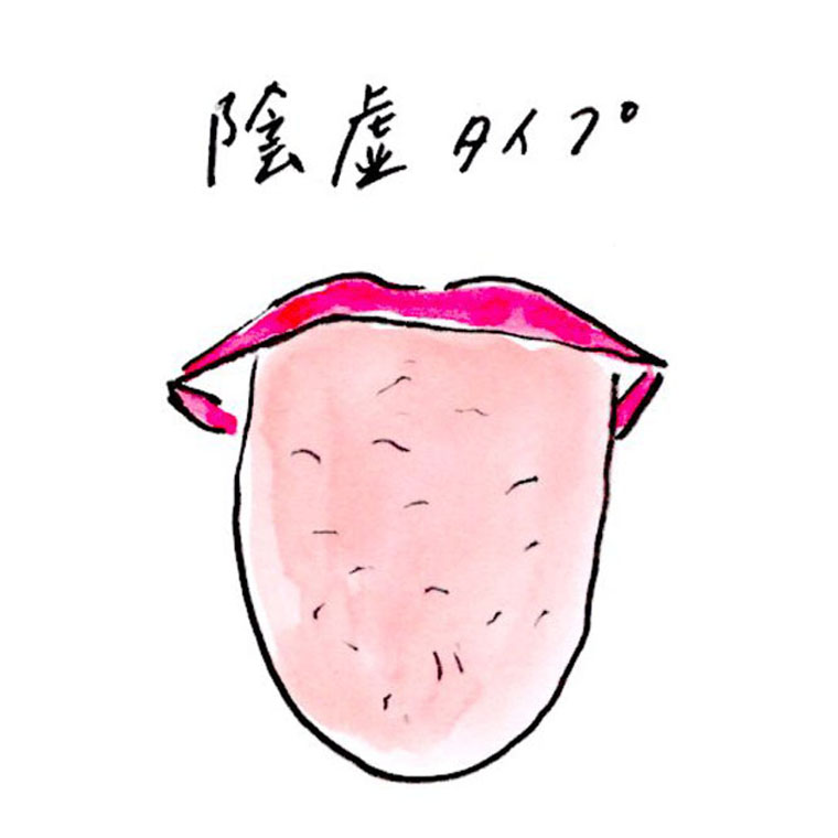 「陰虚（いんきょ）」タイプ