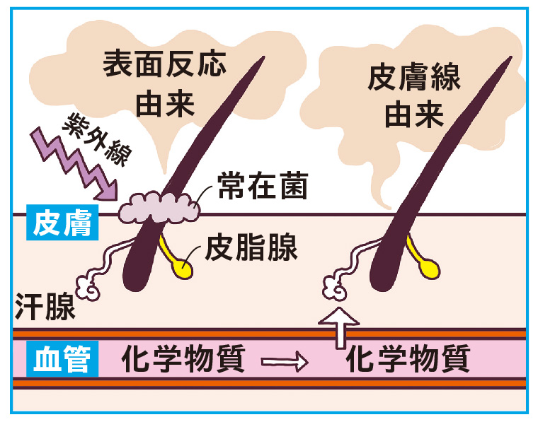 皮膚ガス