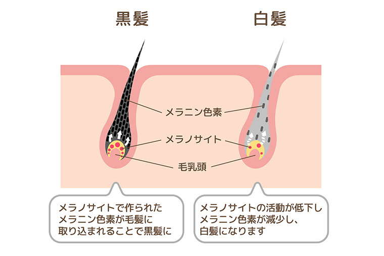 メラノサイト