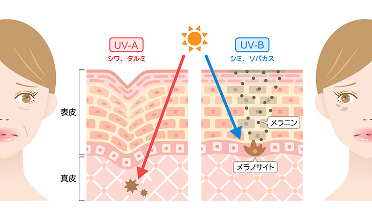 紫外線が肌に与える影響
