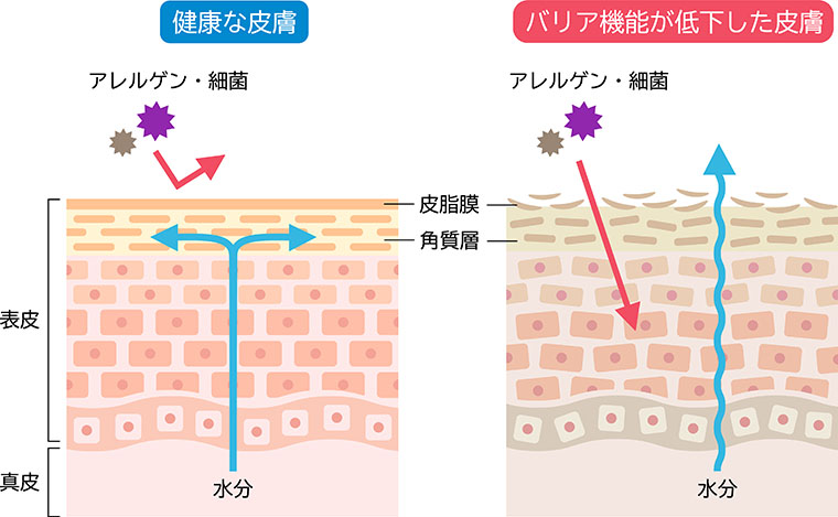 皮膚のイラスト