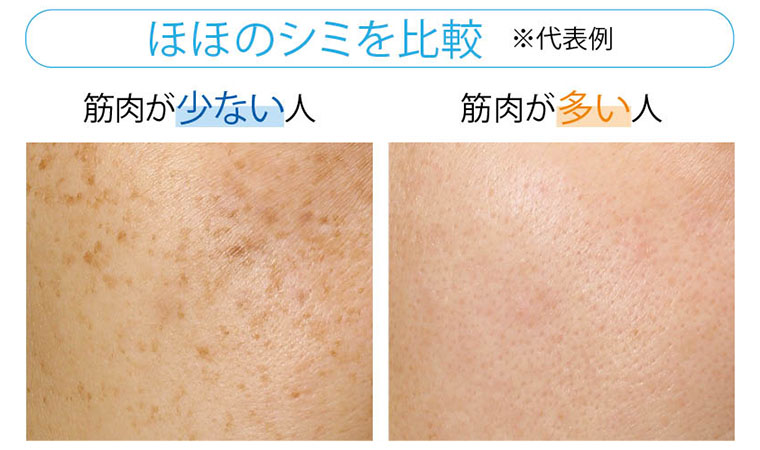 ほほのシミを比較
