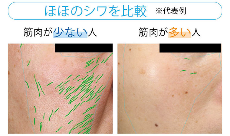 ほほのシワを比較