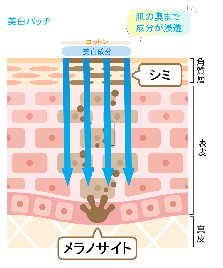 美白パッチの場合