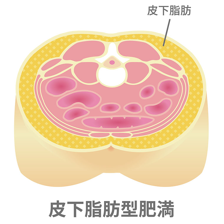 皮下脂肪