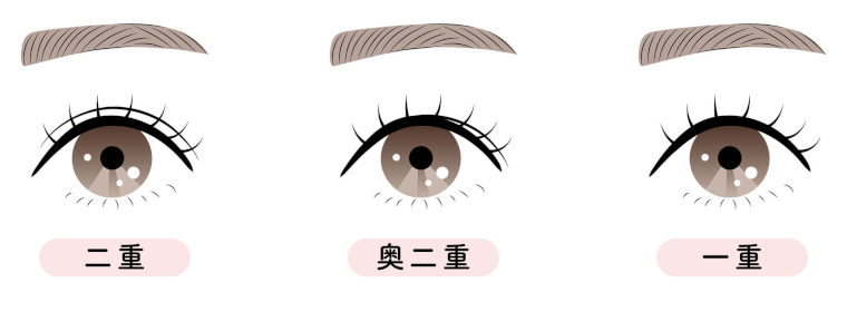 まぶたの形