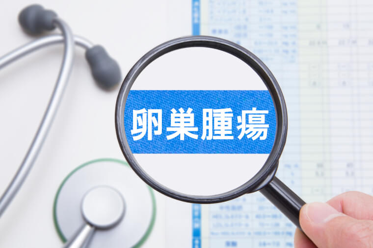 卵巣腫瘍