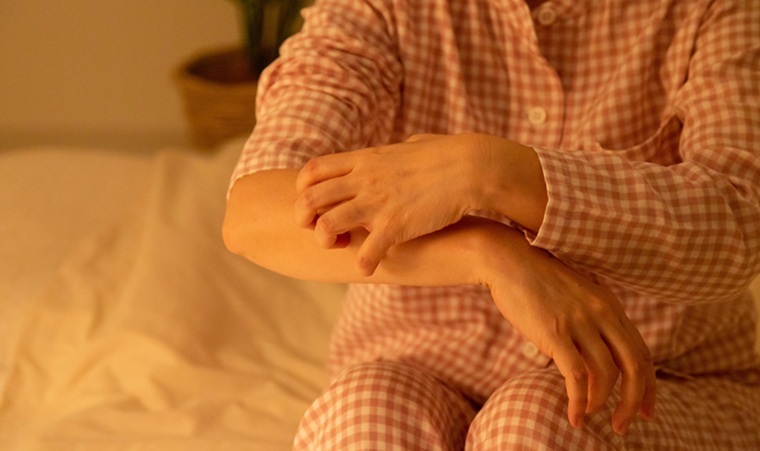 特発性蕁麻疹top