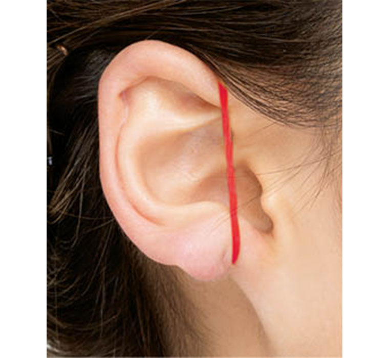 耳が変形するほど強く締め付けるのはNG