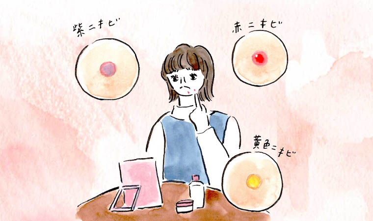 赤・黄色・紫…3タイプ別「大人ニキビ」の色でわかる体質と対策｜田中友也さん 季節の養生法