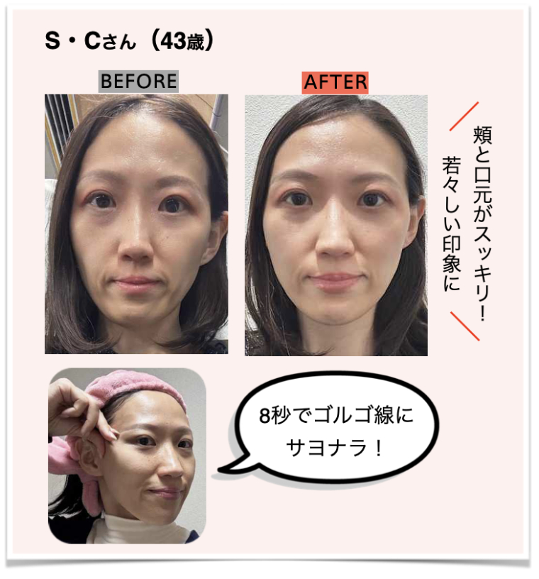 ゴルゴ線つまみS・Cさん