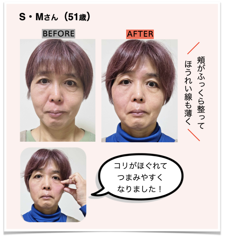 ゴルゴ線つまみS・Mさん