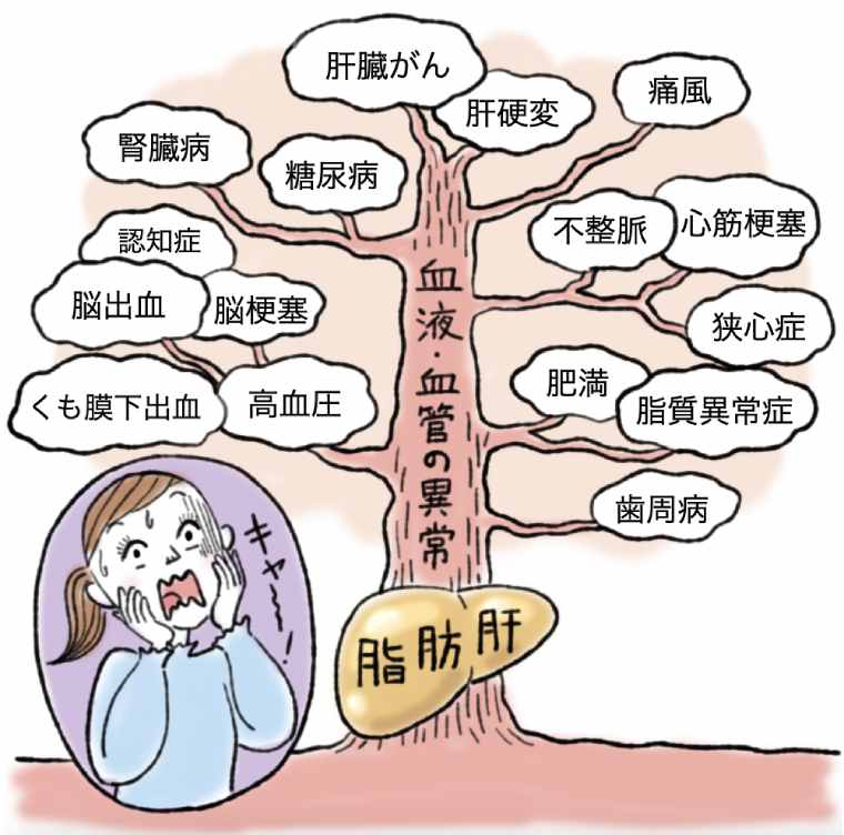 脂肪肝が引き起こす病気