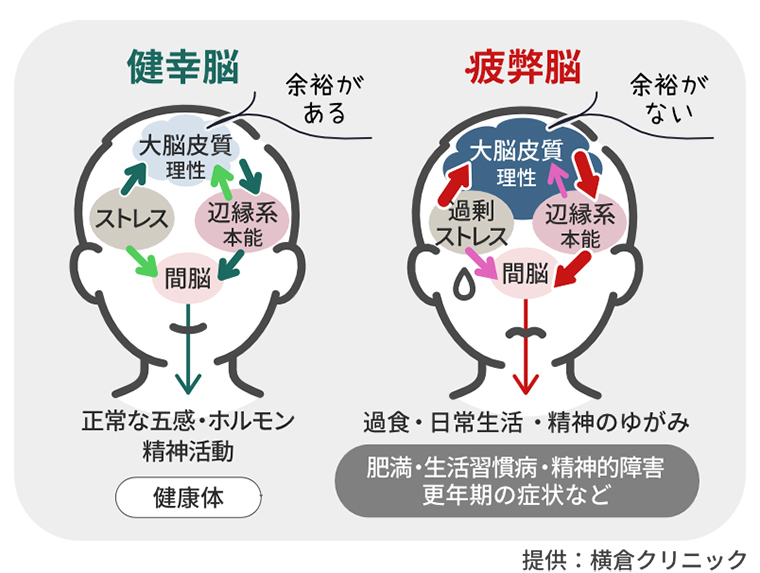 脳のしくみ(横倉クリニック)