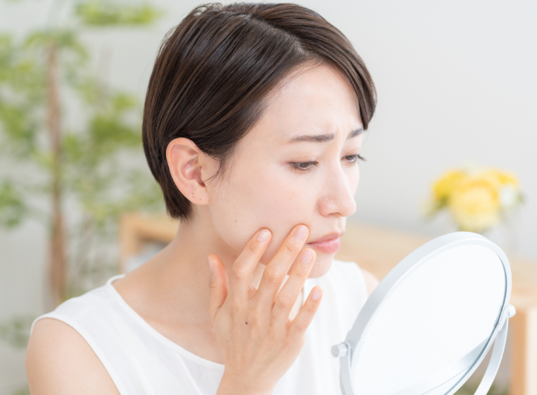 肌荒れで悩む女性