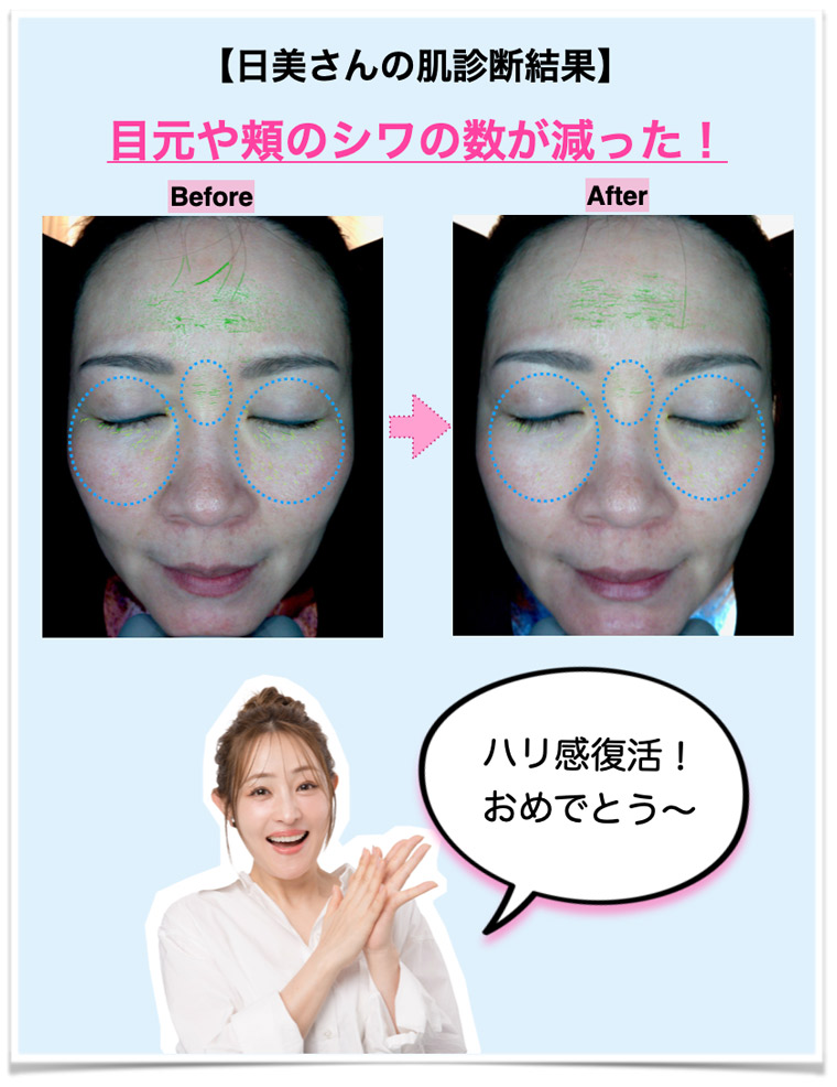 日美さんの肌診断結果