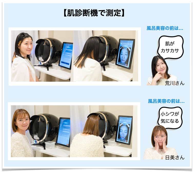 肌診断気で測定中